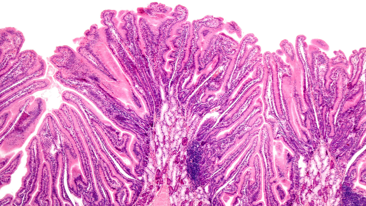 Leaky Gut
